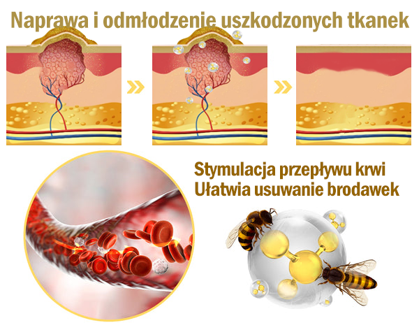 XIMonth® Silny krem do pielęgnacji skóry całego ciała (🔥Ostatni dzień promocji 80% taniej）